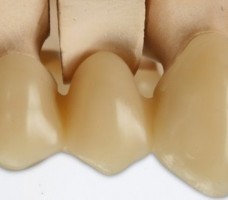 EnvisionTEC® Announces New Perfactory® Vida 3D Printer for the Orthodontic Market